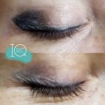Formation IQ remover