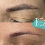 Formation IQ remover